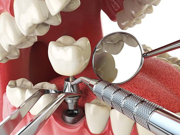 Best Emergency Treatment for Toothache in Mcrae Helena, GA
